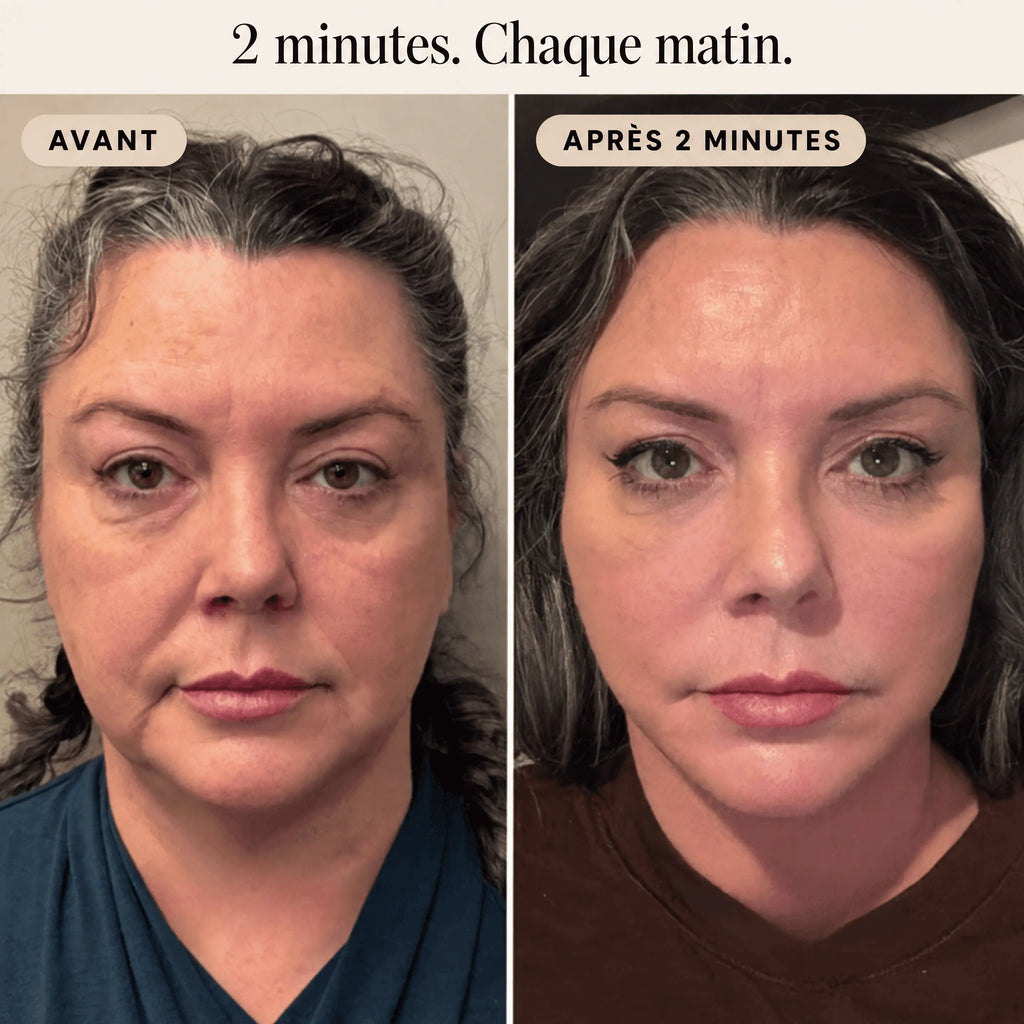 Avant et après 2 minutes de drainage lymphatique du visage avec la brosse Sorya